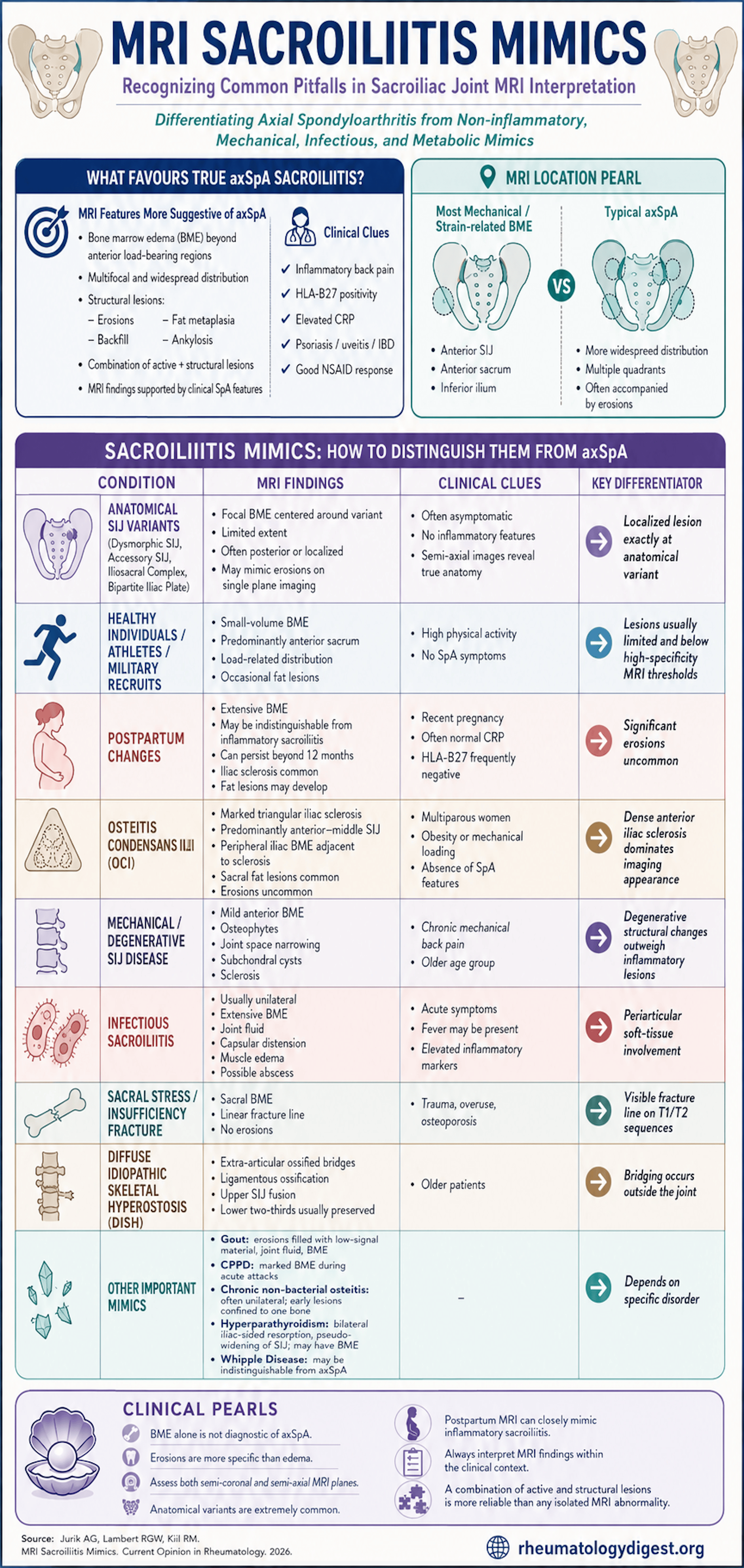 MRI sacroiliitis mimics — distinguishing axSpA from its imaging look-alikes